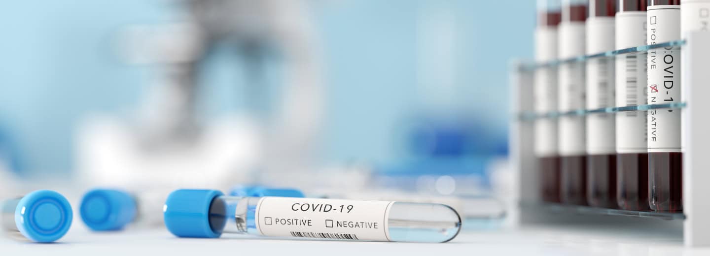 Close-up of COVID-19 test tubes in a lab, emphasizing accurate results to help travelers stay healthy and maintain fitness routines.